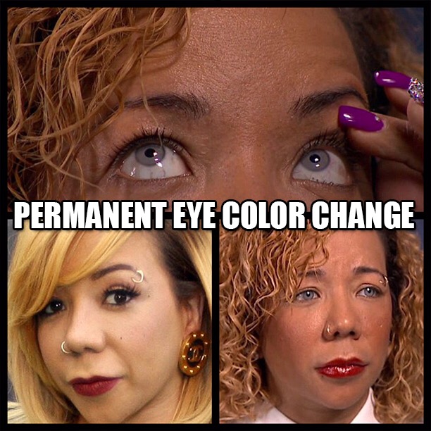 Would you consider permanent eye color procedure? Tiny did 